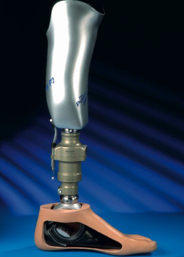 Harmony — система вакуумного крепления протеза.
