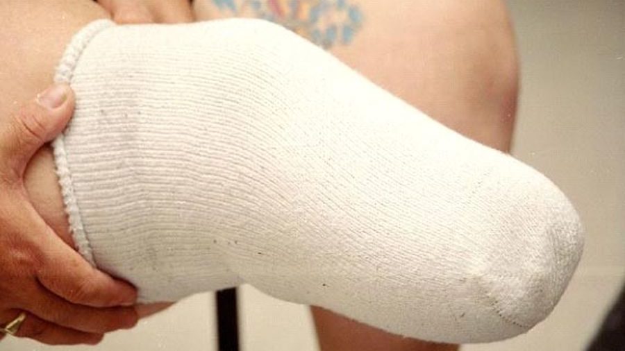 Чулки для культи