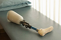 Протезы из дерева — революция в протезировании