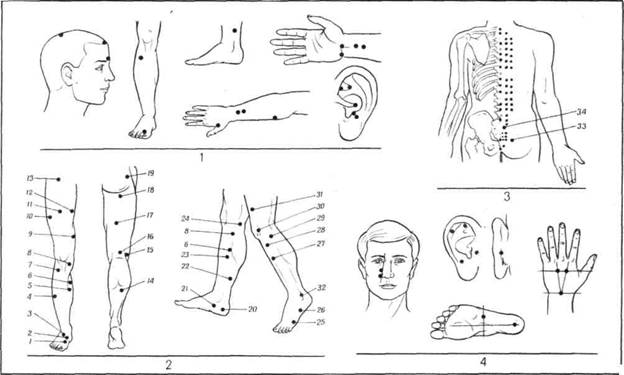 КАК УМЕНЬШИТЬ ФАНТОМНУЮ БОЛЬ