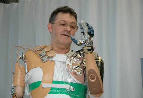 Исследователи стараются достичь бессознательного контроля над искусственными органами