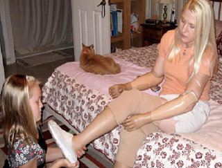 Из-за врачебной ошибки женщина осталась без конечностей