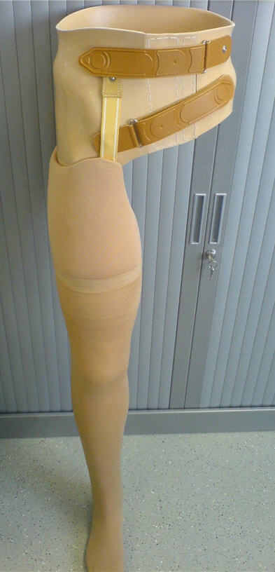 Протезно-ортопедические изделия — бесплатно