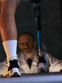 Протезирование после ампутации нижней конечности