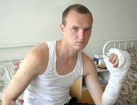 «Когда летел в Киев, думал лишь об одном: «Спасут ли мою руку? пришьют ли все пальцы?»