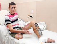 После аварии на скутере 20-летний парень перенес 15 операций