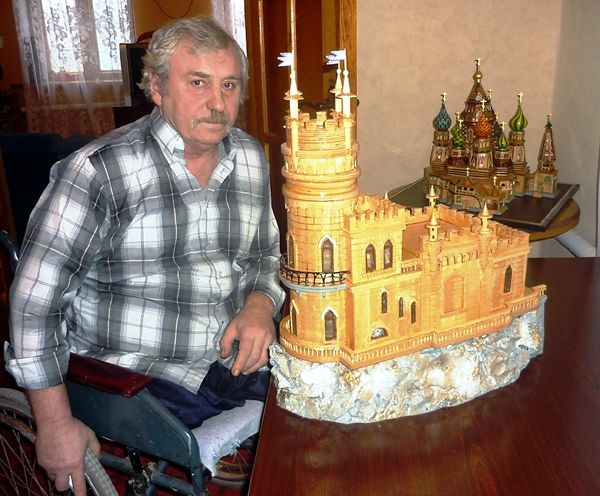 «Из-за атеросклероза у меня настолько сузились сосуды ног, что в них перестала поступать кровь. Я испытывал страшные боли и дал согласие на ампутацию»