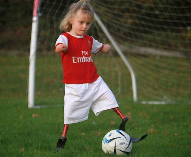 Девочка без ног вошла в школьную команду по футболу