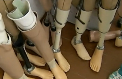 Протез, который мало чем отличается от настоящей ноги