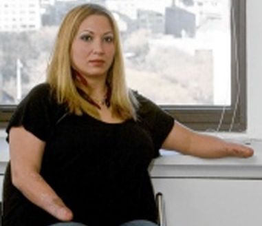 В США женщина-инвалид отсудила у больницы $18 млн