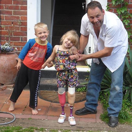 Девочка без ног и рук живет полной жизнью