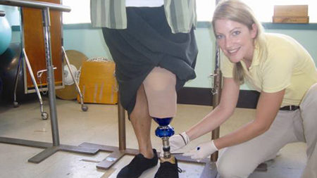 Подготовка к протезированию конечности