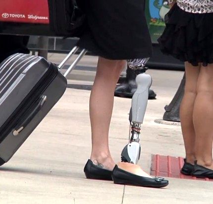 Symbionic Leg от Ossur