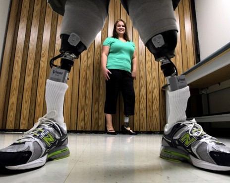 Сделаны протезы ног, управляемые силой мысли