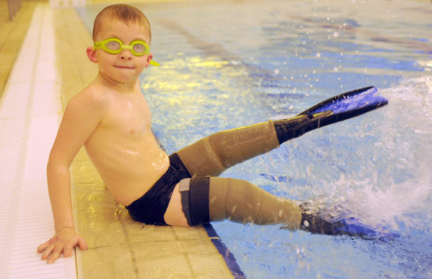 Ребенок потерявший ноги научился плавать благодаря протезам-плавникам