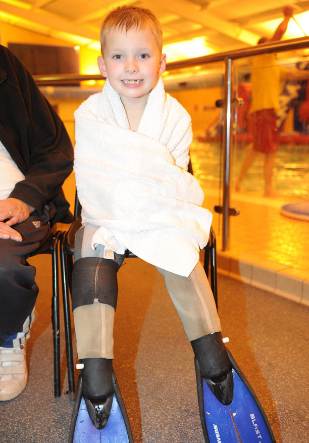 Ребенок потерявший ноги научился плавать благодаря протезам-плавникам