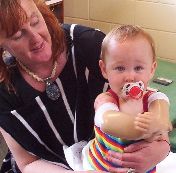 Жизнь без конечностей