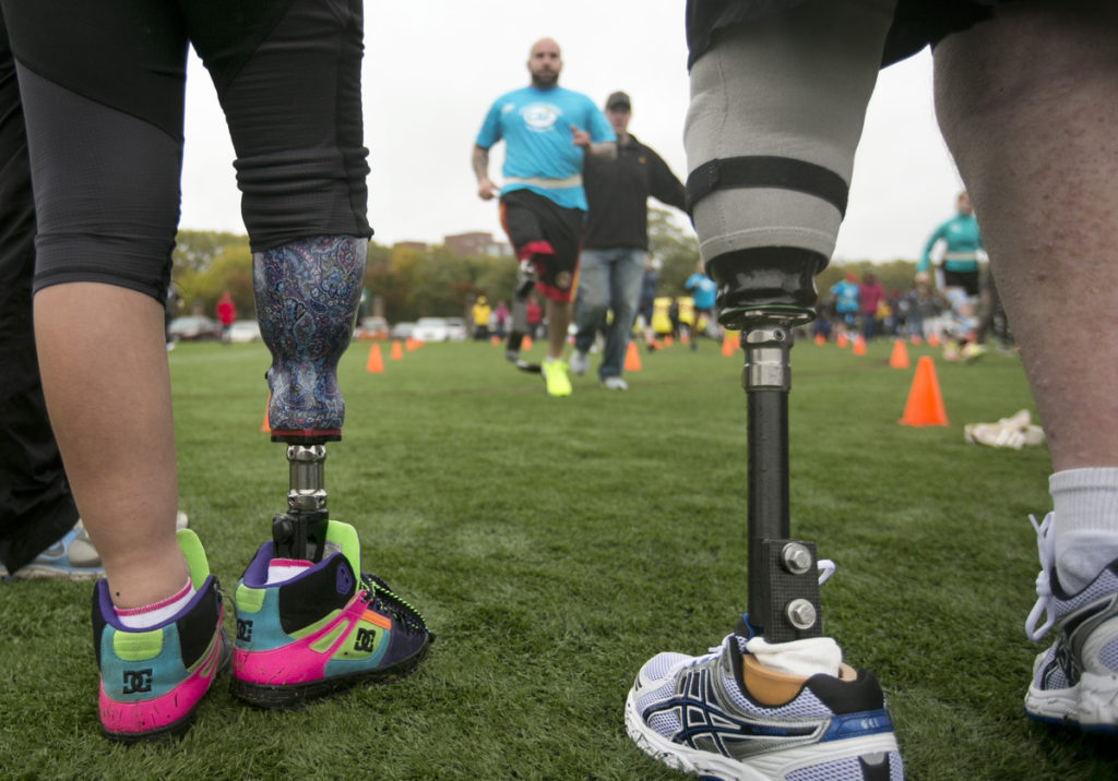 Десятки людей с ампутированными ногами заново учатся бегать на протезах