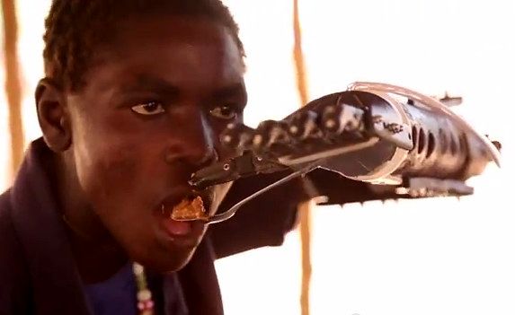 Как 3D — принтеры способны помочь инвалидам с ампутированными конечностями