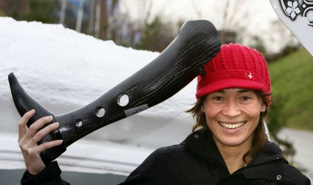 «Ампутация ноги не изменила мою жизнь»