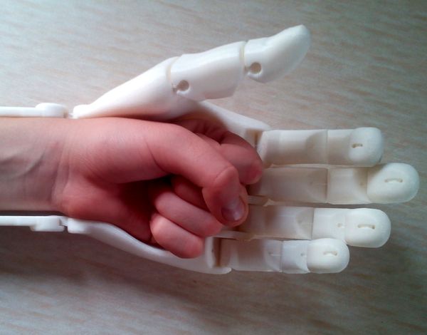 Будущее протезирования с помощью 3D-печати