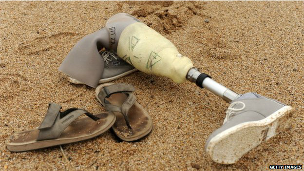 140811135123_prosthetics_artificial_leg_624x351_getty_nocredit