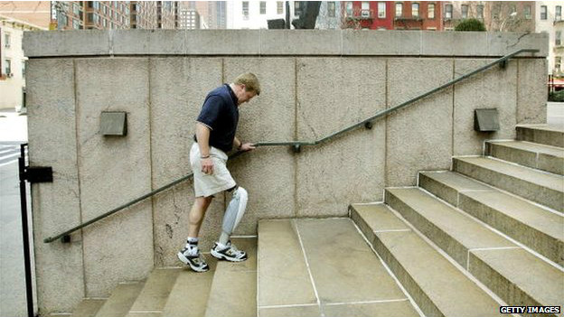 140811135340_prosthetics_artificial_leg_624x351_getty_nocredit