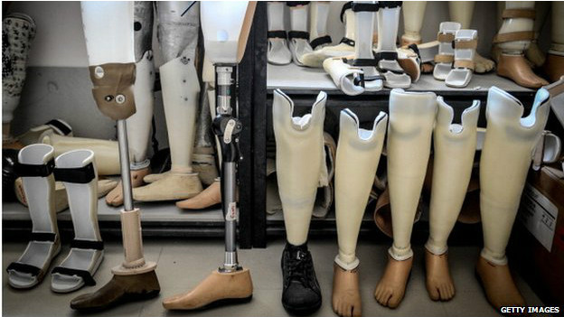 140811135435_prosthetics_artificial_leg_624x351_getty_nocredit