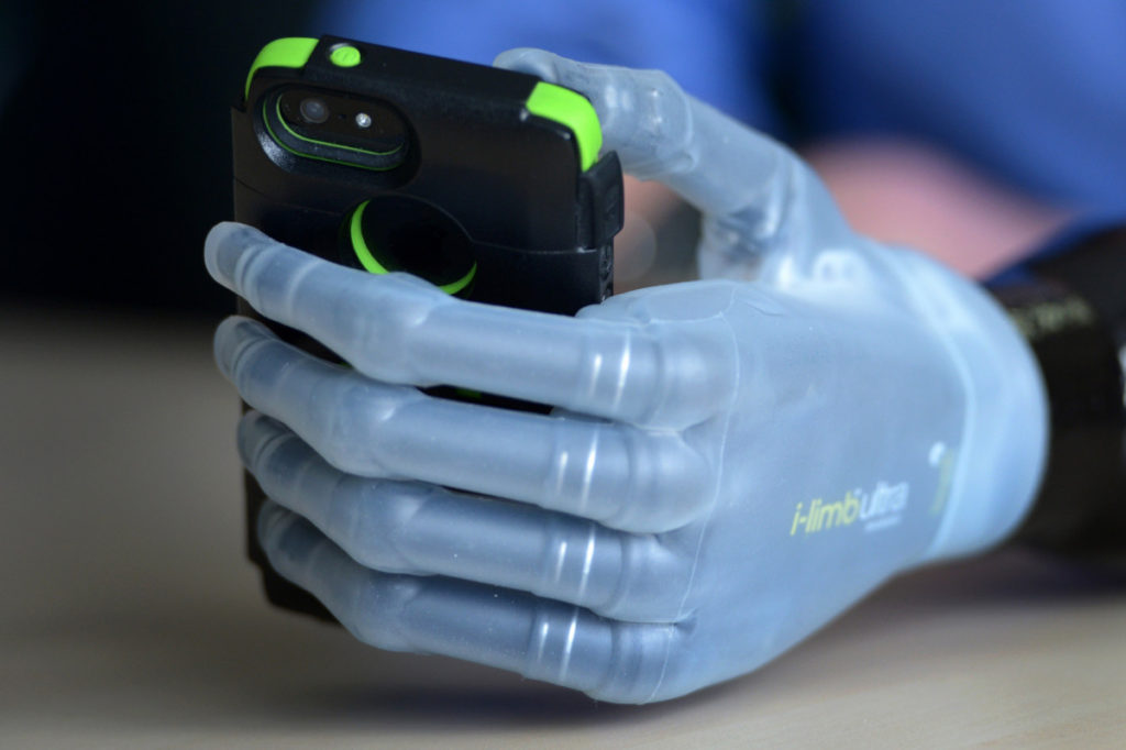 Бионическим протезом управляют с помощью iOS-приложения