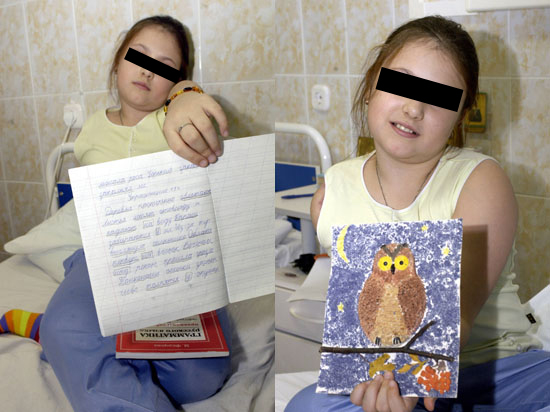 Девочка и протез