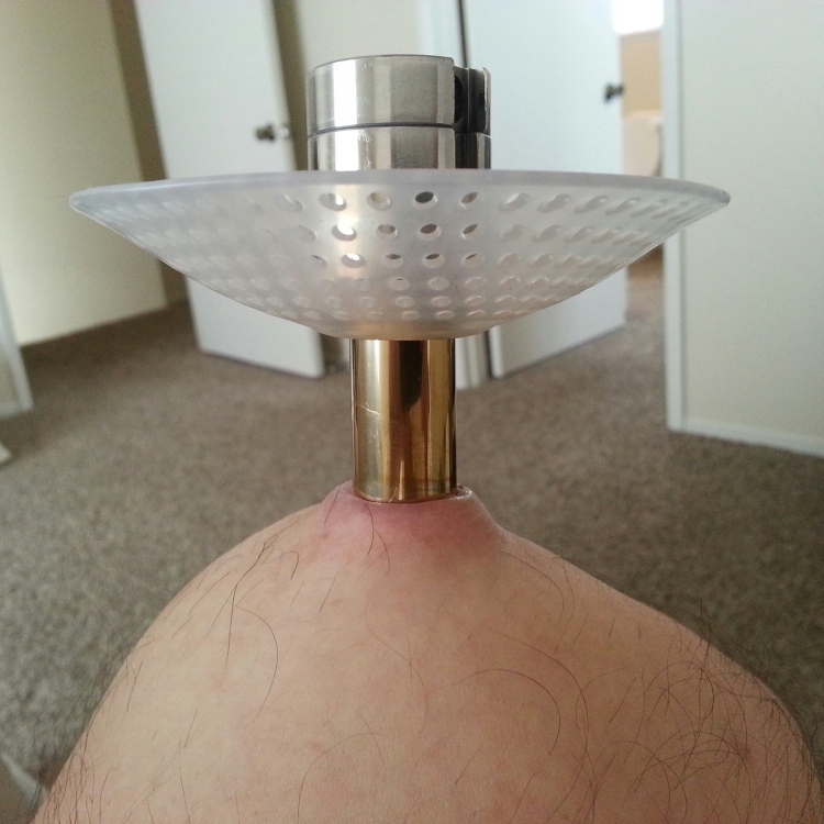 Создан протез ноги, который интегрируется в кость