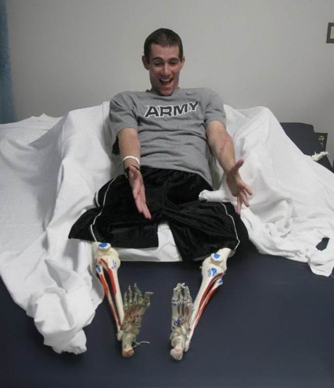 Эти люди с ампутированными конечностями учат нас относиться ко всему с юмором