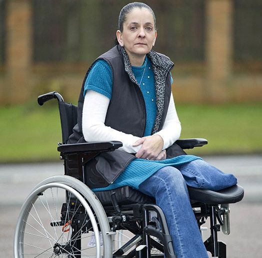 Ампутация ноги в результате врачебной ошибки