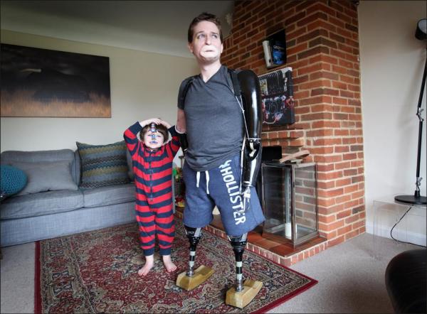 Мужчина, потерявший четыре конечности, поклялся сам подойти к алтарю на свадьбе