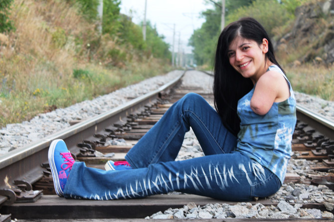 «Считаю себя самым сильным человеком в Армении» – девушка, потерявшая во время войны конечности