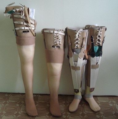 Инвалиды утверждают, что российские протезы прочнее, функциональнее зарубежных аналогов