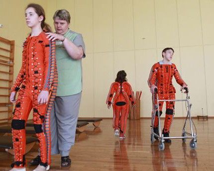 В России появится государственная протезная компания