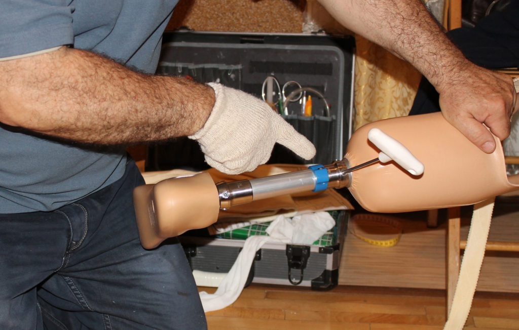 Что делать если протез ноги натирает