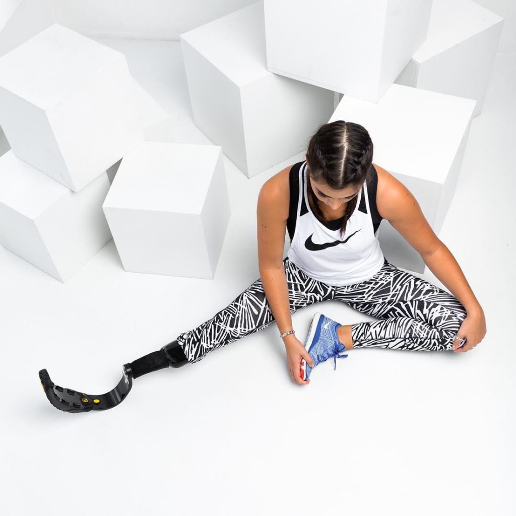 23-летней девушке с одной ногой поклонники прочат карьеру в индустрии моды