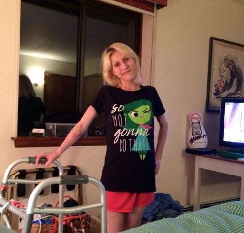 27-летняя девушка, страдающая от диабета, вышла из комы и обнаружила, что врачи ампутировали ей ногу