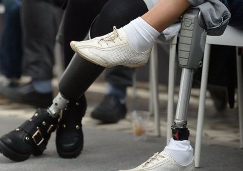 Почему ампутированные конечности «болят»