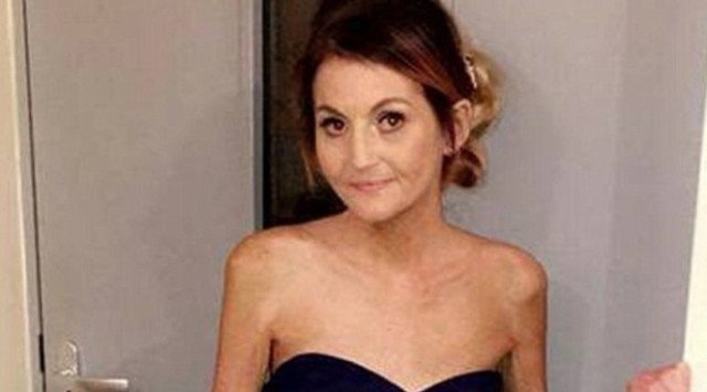 ампутация ноги