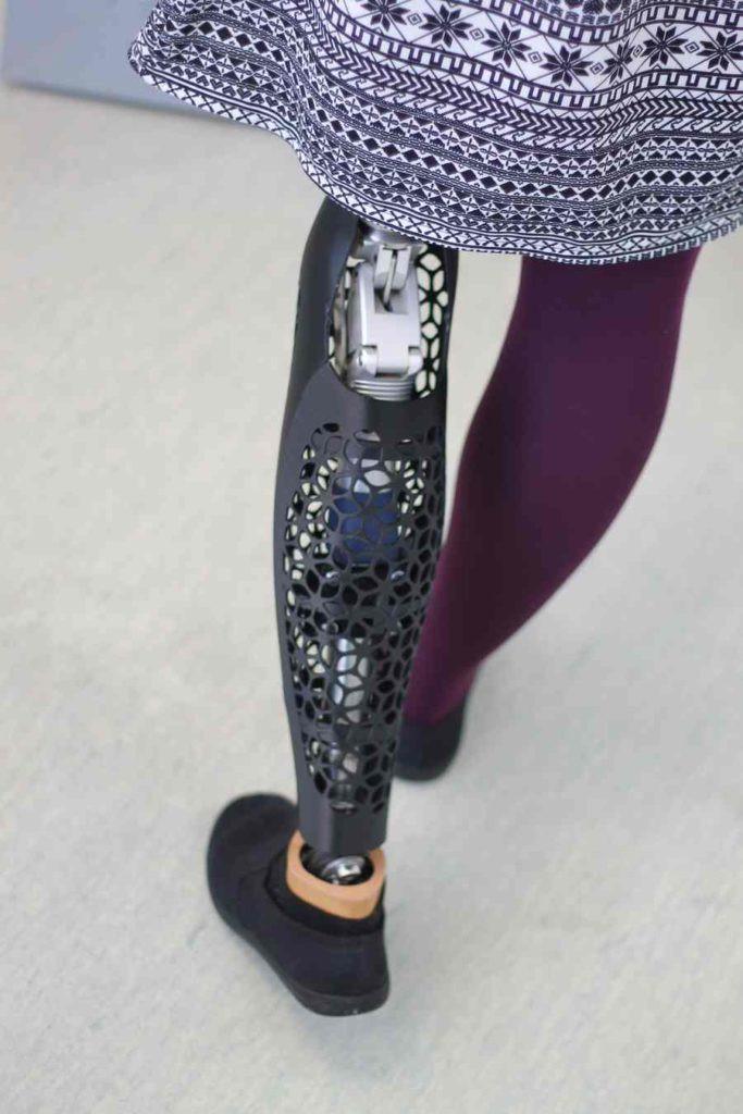 Рижский прорыв в эволюции протезов