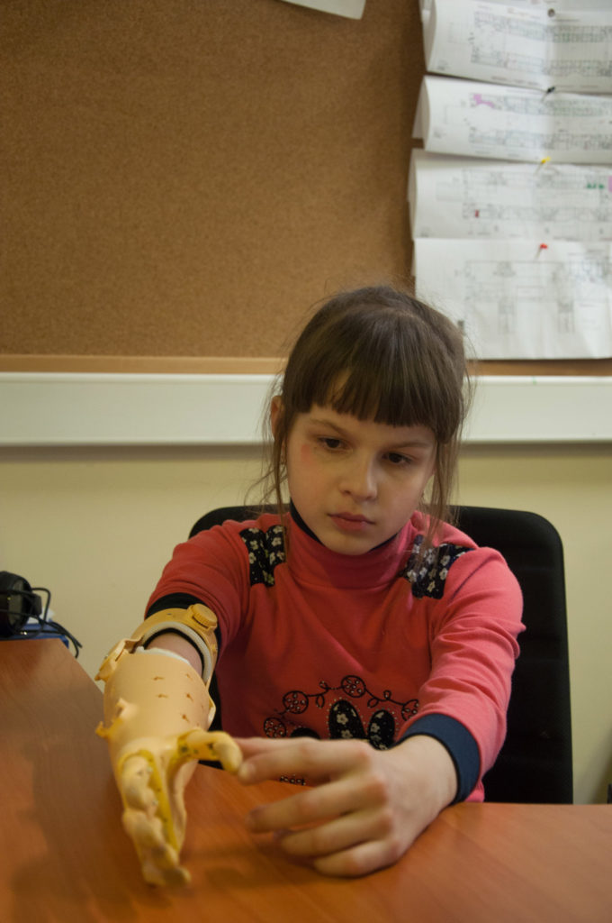 Как живут люди с протезами конечностей