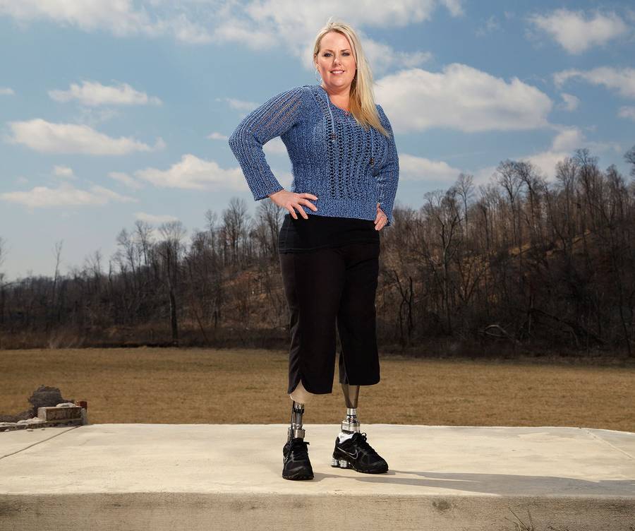 Героическая мама потеряла ноги спасая детей от торнадо