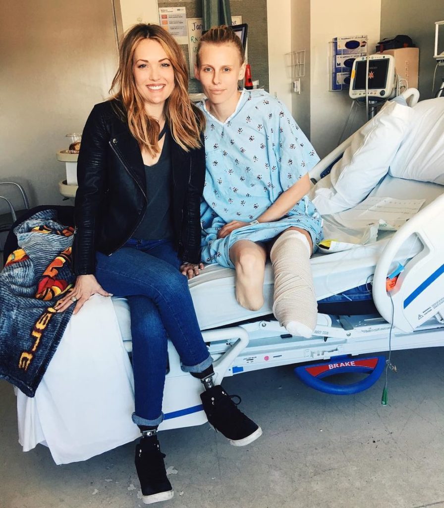 Американская модель лишилась второй ноги после использования тампона с инфекцией