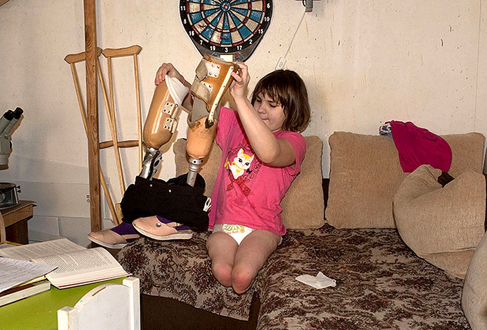 Модульные протезы для Василины