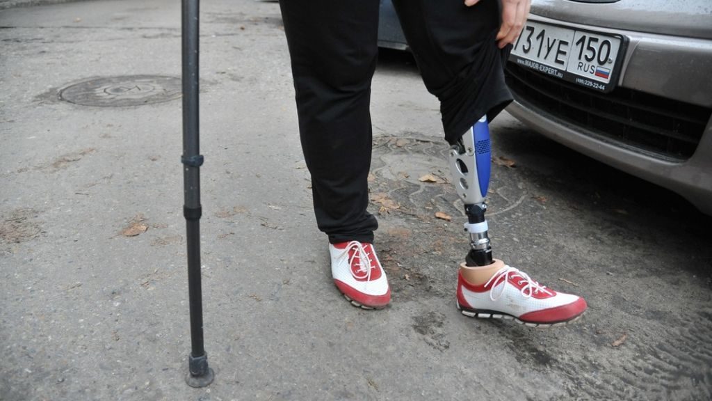 Как получить бесплатный протез