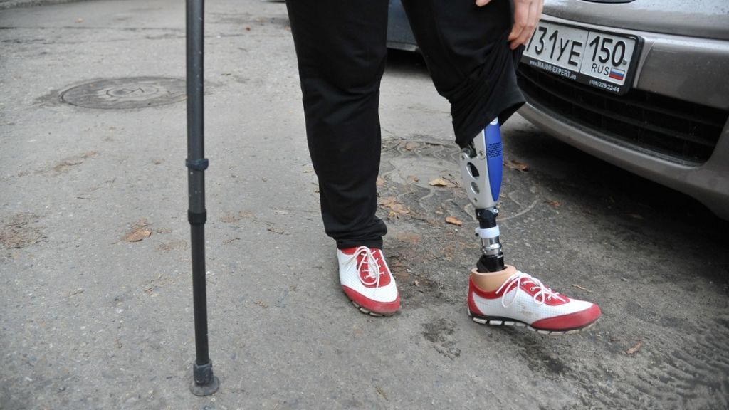 Как получить бесплатный протез