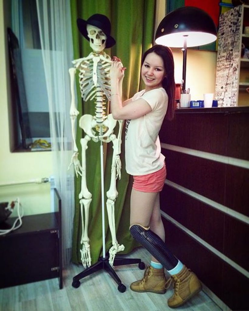 Девушка победившая страх научилась танцевать с протезом ноги